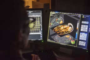 Functional Magnetic Resonance Imaging scans