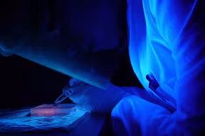 Cutting DNA bands from an agarose gel in the laboratory