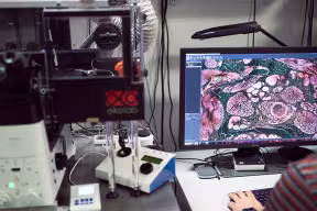 Looking at samples through a microscope, Department of Oncology