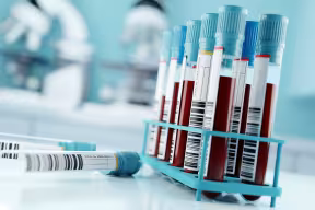 Hospital blood samples