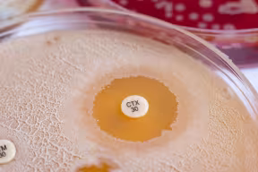 A petri dish containing a film of bacteria growing on agar. There is a clear zone around a small disc labelled CTX30.