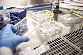 Oxford Bundibugyo ebolavirus vaccine candidate receives CEPI backing