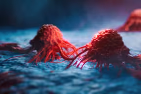 First trial of vaccine to prevent Lynch syndrome-associated cancers approved to start in Oxford