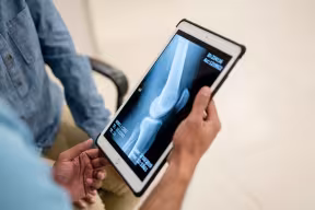 Kneecap replacement surgery