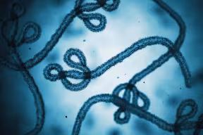 A 3D render of ebolavirus cells under a microscope