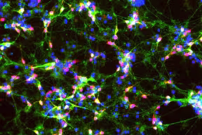 Image of brain synapses