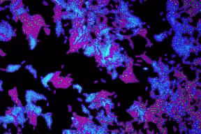 Microscopy image of two fluorescent strains of P. aeruginosa
