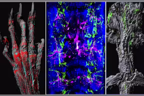 Role of lymphatic system in bone healing revealed