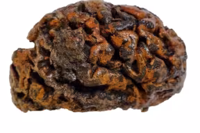 A preserved human brain.