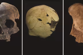 Three panels showing: A large fragment from a human skull showing signs of damage caused by blunt force. Fragments of a human skull pieced together, showing two holes caused by damage. A human foot bone showing damage to reveal the spongy layer within.