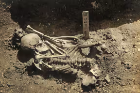 he was clearly the victim of a shark attack. The man may well have been fishing with companions at the time, since he was recovered quickly. And, based on the character and distribution of the tooth marks, the most likely species responsible was either a 
