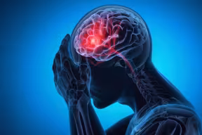 Illustrative graphic seeing into a person’s head with their brain inflamed with pain signals. 