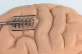 A rectangular see-through wafer with embedded electrodes overlaid on the surface of a model brain. 