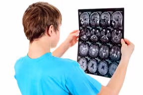 Student looking at brain scan