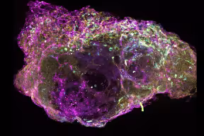 Whole bone marrow organoid (Dr A Khan)
