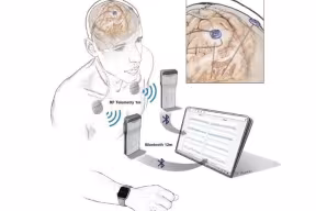 Illustration of new generation of neurostimulation devices