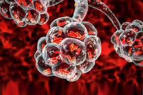 Rod-shaped Pseudomonas aeruginosa bacteria fill the alveoli sacs of an individual’s lungs. The alveolar sacs appear as a cluster of tiny, interconnected air sacs resembling a delicate network of bubbles. Credit: Shutterstock.