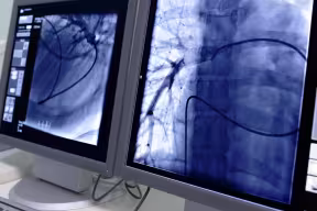 Computer screen showing scans of lungs