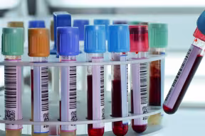 Photo | Technician placing blood tubes in the laboratory centrifuge