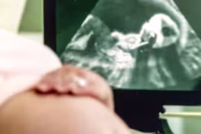 Pregnant woman getting ultrasound