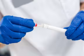 Photo | Doctor holds swab test in their hands.