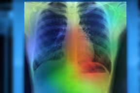 Image scan of lungs